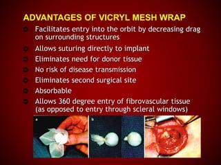 ADVANTAGES OF VICRYL MESH WRAP
 Facilitates entry into the orbit by decreasing drag
on surrounding structures
 Allows suturing directly to implant
 Eliminates need for donor tissue
 No risk of disease transmission
 Eliminates second surgical site
 Absorbable
 Allows 360 degree entry of fibrovascular tissue
(as opposed to entry through scleral windows)
 