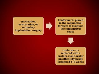 enucleation,
evisceration, or
secondary
implantation surgery
Conformer is placed
in the conjunctival
fornices to maintain
the conjunctival
space
conformer is
replaced with a
custom-made ocular
prosthesis typically
fashioned 4–6 weeks
 
