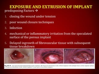 EXPOSURE AND EXTRUSION OF IMPLANT
predisposing Factors 
1. closing the wound under tension
2. poor wound closure techniques
3. Infection
4. mechanical or inflammatory irritation from the speculated
surface of the porous implant
5. Delayed ingrowth of fibrovascular tissue with subsequent
tissue breakdown
 