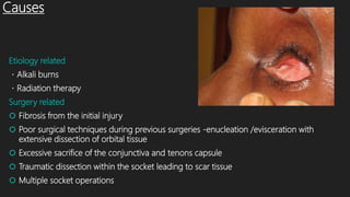 Causes
Etiology related
・Alkali burns
・Radiation therapy
Surgery related
 Fibrosis from the initial injury
 Poor surgical techniques during previous surgeries -enucleation /evisceration with
extensive dissection of orbital tissue
 Excessive sacrifice of the conjunctiva and tenons capsule
 Traumatic dissection within the socket leading to scar tissue
 Multiple socket operations
 