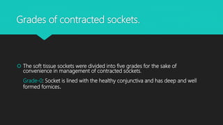 Grades of contracted sockets.
 The soft tissue sockets were divided into five grades for the sake of
convenience in management of contracted sockets.
Grade-0: Socket is lined with the healthy conjunctiva and has deep and well
formed fornices.
 