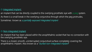  Integrated implant:
an implant that can be directly coupled to the overlying prosthetic eye with a peg system.
As there is a small break in the overlying conjunctiva through which the peg protrudes,
Sometimes known as a partially exposed integrated implant
 Non-integrated implant
An implant that has been placed within the anophthalmic socket that has no connection with
the overlying prosthetic eye.
There is a closed, smooth, uninterrupted conjunctival surface completely covering the
anophthalmic implant. Also known as a “buried non-integrated implant”
 