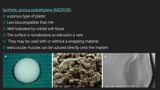 Synthetic porous polyethylene (MEDPOR)
 a porous type of plastic
 Less biocompatible than HA
 Well tolerated by orbital soft tissue
 The surface is nonabrasive so extrusion is rare.
 They may be used with or without a wrapping material
 extra ocular muscles can be sutured directly onto the implant
 