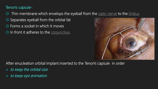 Tenon's capsule-
 Thin membrane which envelops the eyeball from the optic nerve to the limbus
 Separates eyeball from the orbital fat
 Forms a socket in which it moves
 In front it adheres to the conjunctiva.
After enucleation orbital implant inserted to the Tenon's capsule in order
 to keep the orbital size
 to keep eye animation
 