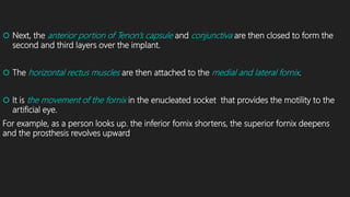  Next, the anterior portion of Tenon’s capsule and conjunctiva are then closed to form the
second and third layers over the implant.
 The horizontal rectus muscles are then attached to the medial and lateral fornix.
 It is the movement of the fornix in the enucleated socket that provides the motility to the
artificial eye.
For example, as a person looks up. the inferior fomix shortens, the superior fornix deepens
and the prosthesis revolves upward
 