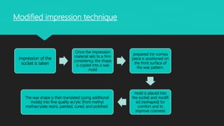 impression of the
socket is taken
Once the impression
material sets to a firm
consistency, the shape
is copied into a wax
mold
prepared iris–cornea
piece is positioned on
the front surface of
the wax pattern.
mold is placed into
the socket and modifi
ed (reshaped) for
comfort and to
improve cosmesis
The wax shape is then translated (using additional
molds) into fine quality acrylic (from methyl
methacrylate resin), painted, cured, and polished.
Modified impression technique
 