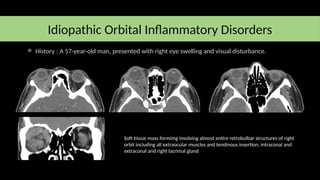 Orbital infection and inflamation new.pptx