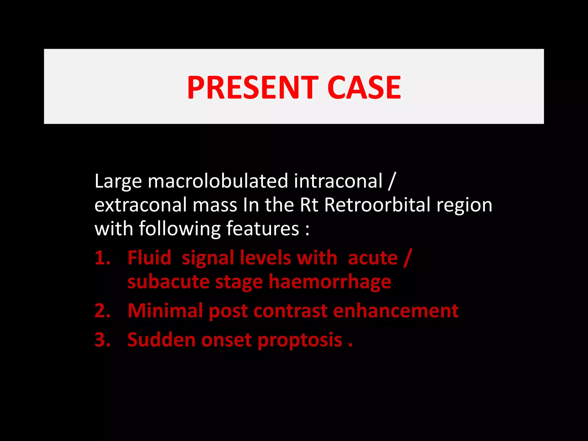 Practical Approach to Orbital Lesions by Anatomic Compartments |  RadioGraphics, image size:2048x1536