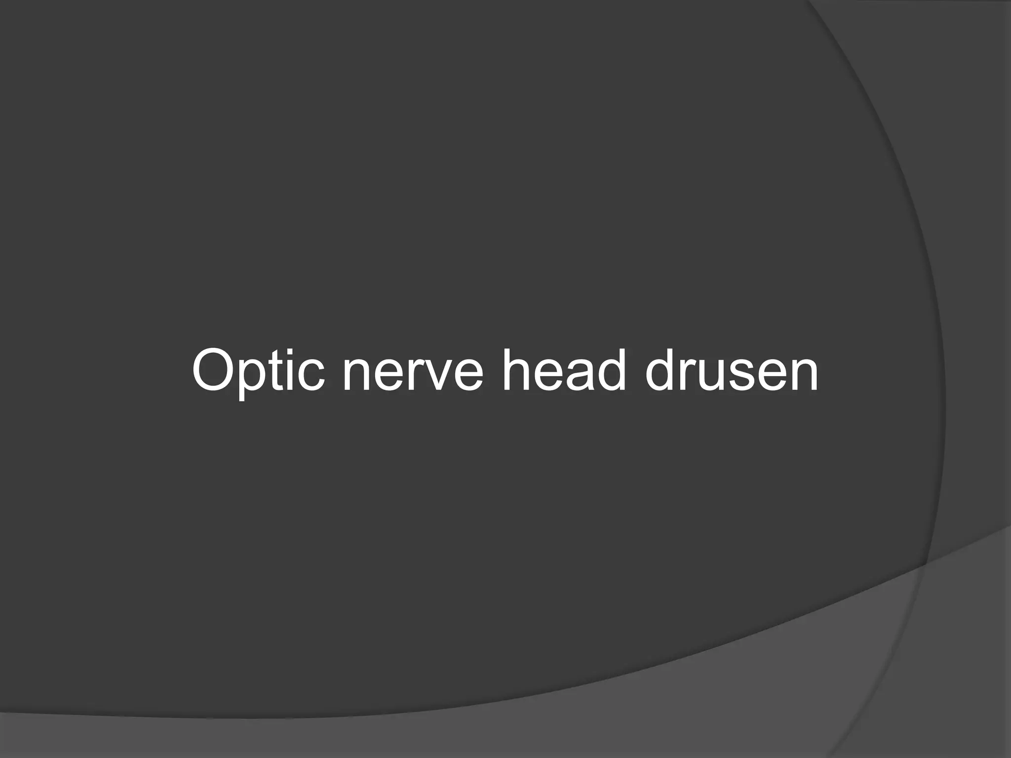 Optic nerve head drusen
 