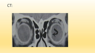 Orbital pathology pk 1 ppt pdf | PPTX