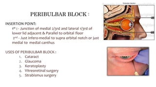 INSERTION POINT:
1st : - Junction of medial 2/3rd and lateral 1/3rd of
lower lid adjacent & Parallel to orbital floor
2nd - Just infero-medial to supra orbital notch or just
medial to medial canthus
USES OF PERIBULBAR BLOCK :
1. Cataract
2. Glaucoma
3. Keratoplasty
4. Vitreoretinal surgery
5. Strabismus surgery
PERIBULBAR BLOCK :
 