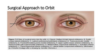Surgical Approach to Orbit
 