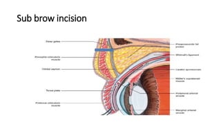 Sub brow incision
 