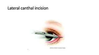 Lateral canthal incision
 