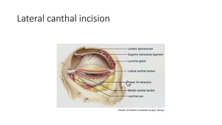 Lateral canthal incision
 