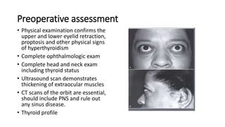 Preoperative assessment
• Physical examination confirms the
upper and lower eyelid retraction,
proptosis and other physical signs
of hyperthyroidism
• Complete ophthalmologic exam
• Complete head and neck exam
including thyroid status
• Ultrasound scan demonstrates
thickening of extraocular muscles
• CT scans of the orbit are essential,
should include PNS and rule out
any sinus disease.
• Thyroid profile
• .
 