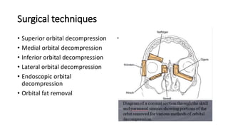 Surgical techniques
• Superior orbital decompression
• Medial orbital decompression
• Inferior orbital decompression
• Lateral orbital decompression
• Endoscopic orbital
decompression
• Orbital fat removal
• .
 