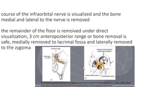 course of the infraorbital nerve is visualized and the bone
medial and lateral to the nerve is removed
the remainder of the floor is remoived under direct
visualization, 3 cm anteroposterior range or bone removal is
safe, medially remioved to lacrimal fossa and laterally removed
to the zygoma
 