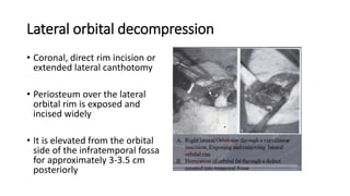 Lateral orbital decompression
• Coronal, direct rim incision or
extended lateral canthotomy
• Periosteum over the lateral
orbital rim is exposed and
incised widely
• It is elevated from the orbital
side of the infratemporal fossa
for approximately 3-3.5 cm
posteriorly
• .
 