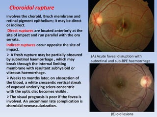 Orbital trauma | PPTX