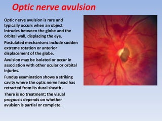 Orbital trauma | PPTX