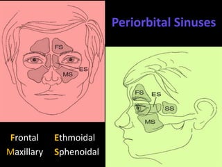 Frontal Ethmoidal
Maxillary Sphenoidal
Periorbital Sinuses
 