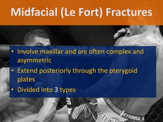 Midfacial (Le Fort) Fractures
• Involve maxillar and are often complex and
asymmetric
• Extend posteriorly through the pterygoid
plates
• Divided into 3 types
 