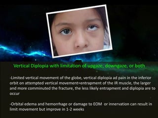 Vertical Diplopia with limitation of upgaze, downgaze, or both
-Limited vertical movement of the globe, vertical diplopia ad pain in the inferior
orbit on attempted vertical movement=entrapment of the IR muscle, the larger
and more comminuted the fracture, the less likely entrapment and diplopia are to
occur
-Orbital edema and hemorrhage or damage to EOM or innervation can result in
limit movement but improve in 1-2 weeks
 