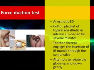Force duction test
– Anesthetic ED
– Cotton pledget of
topical anesthetic in
inferior cul-de-sac for
several minutes
– Toothed forceps
engages the insertion of
IR muscle through the
conjunctiva
– Attempts to rotate the
globe up and down
gently
 
