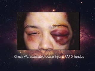 : Check VA, associated ocular injury, RAPD, fundus
 