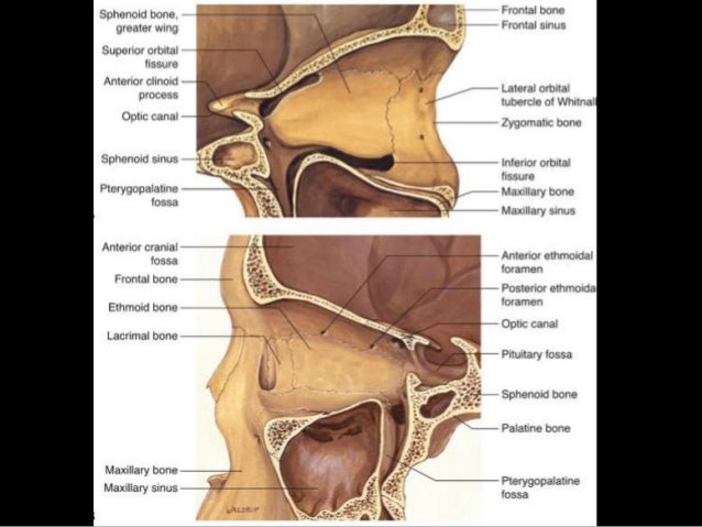 Orbital Blowout Fracture Wikipedia The Free Encyclopedia Blowout Fracture Nuclear Medicine