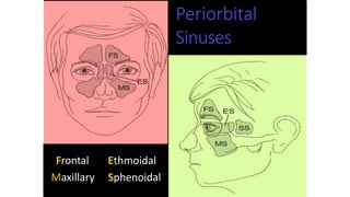 Frontal
Maxillary
Ethmoidal
Sphenoidal
Periorbital
Sinuses
 