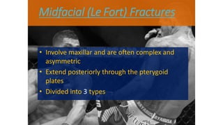 Midfacial (Le Fort) Fractures
• Involve maxillar and are often complex and
asymmetric
• Extend posteriorly through the pterygoid
plates
• Divided into 3 types
 