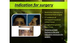 • Restrictive diplopia in a
functional field of gaze
• CT evidence of
entrapped muscle or
orbital tissue
• Enopthalmos greater
than 2 mm
• Presence of NOE
fracture is the only
indication necessary for
surgery
Indication for surgery
 