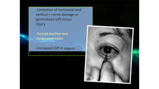 -Limitation of horizontal and
vertical = nerve damage or
generalized soft tissue
injury
-Forced duction test
shows restriction
-Increased IOP in upgaze
> primary position
 