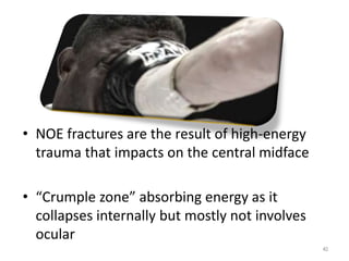 • NOE fractures are the result of high-energy
trauma that impacts on the central midface
• “Crumple zone” absorbing energy as it
collapses internally but mostly not involves
ocular
40
 