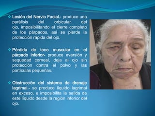 Obstrucción del sistema de drenaje lagrimal.- se produce líquido lagrimal en exceso, e imposibilita la salida de este líquido desde la región inferior del ojo.Inflamación de las Glándulas palpebralesObstrucción de los conductos de las glándulas ciliares de los párpados.- se desarrolla en el párpado un orzuelo, un tumor doloroso, de color rojizo y supurante.