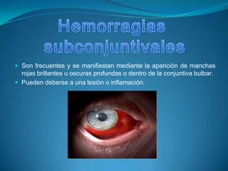 Inflamación conjuntival o conjuntivitis.- infección ocular común y contagiosa.Hemorragias subconjuntivalesSon frecuentes y se manifiestan mediante la aparición de manchas rojas brillantes u oscuras profundas o dentro de la conjuntiva bulbar.Pueden deberse a una lesión o inflamación.