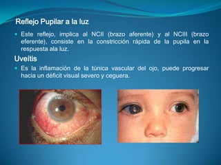 Está formado por tres capas:Capa Fibrosa (externa)Formada por :La esclera, porción opaca y densa de la capa, que cubre los cinco sextos posteriores del ojo.