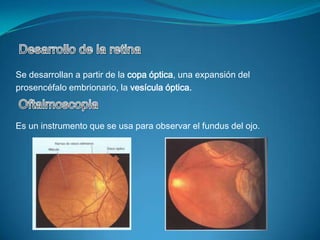 Reflejo Pupilar a la luzEste reflejo, implica al NCII (brazo aferente) y al NCIII (brazo eferente), consiste en la constricción rápida de la pupila en la respuesta ala luz.UveítisEs la inflamación de la túnica vascular del ojo, puede progresar hacia un déficit visual severo y ceguera.