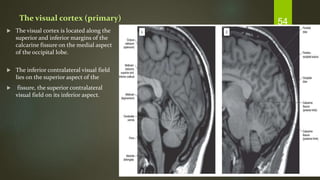 Radiological anatony of orbit | PPTX