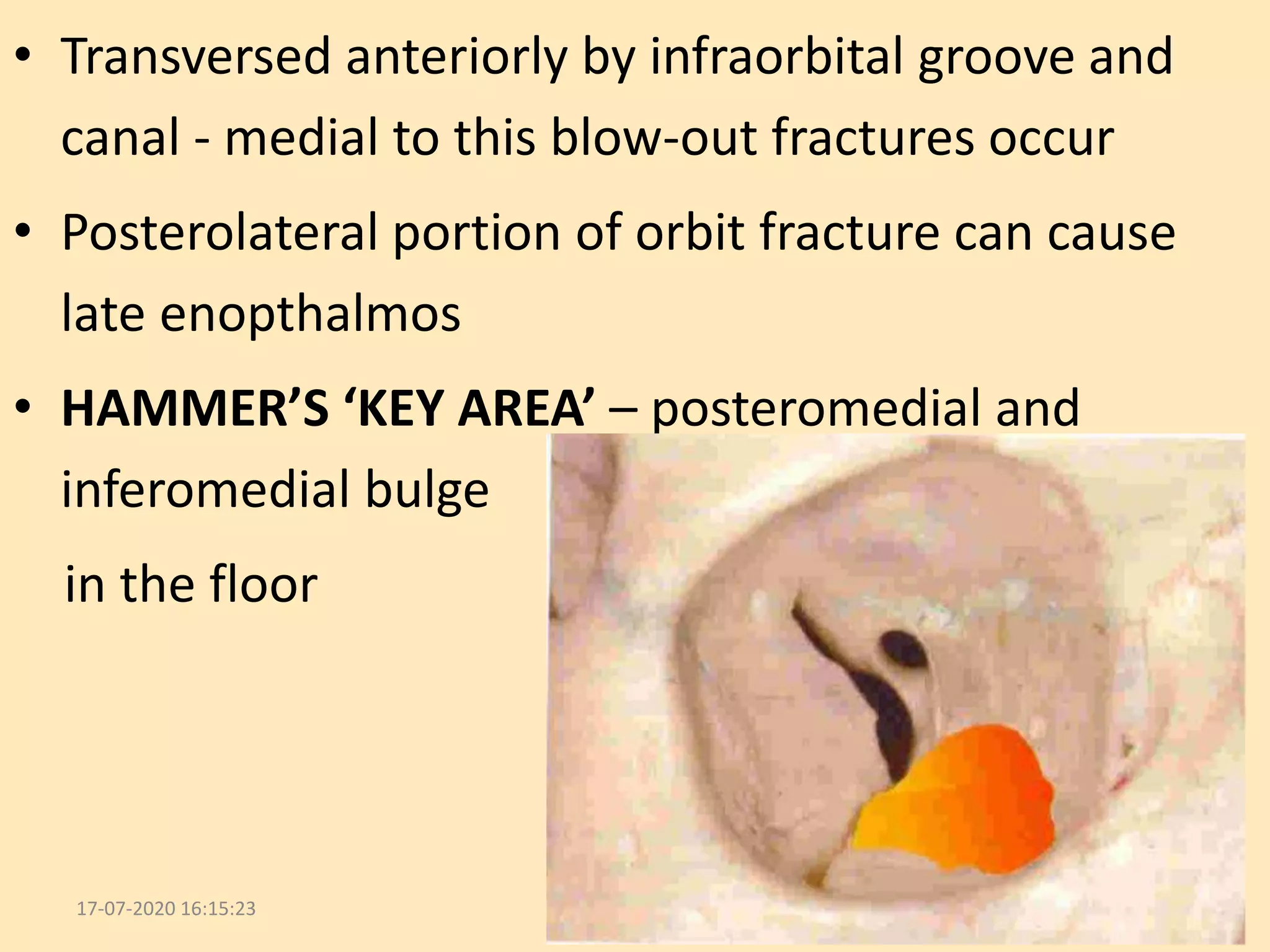 Surgical Anatomy of Orbit | PPTX