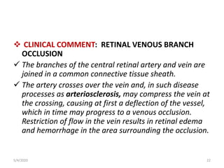  CLINICAL COMMENT: RETINAL VENOUS BRANCH
OCCLUSION
 The branches of the central retinal artery and vein are
joined in a common connective tissue sheath.
 The artery crosses over the vein and, in such disease
processes as arteriosclerosis, may compress the vein at
the crossing, causing at first a deflection of the vessel,
which in time may progress to a venous occlusion.
Restriction of flow in the vein results in retinal edema
and hemorrhage in the area surrounding the occlusion.
5/4/2020 22
 