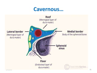 Cavernous…
5/4/2020 70
 