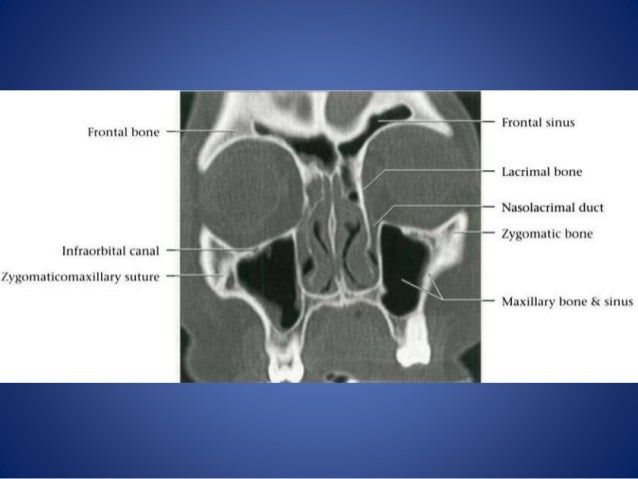 Orbit imaging anatomy