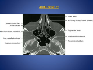 AXIAL BONE CT
 