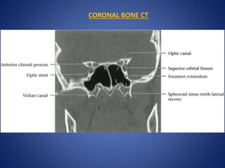 CORONAL BONE CT
 