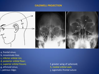 CALDWELL PROJECTION
a, frontal sinus;
b, innominate line;
c, inferior orbital rim;
d, posterior orbital floor;
e, superior orbital fissure; f, greater wing of sphenoid;
g, ethmoid sinus; h, medial orbital wall;
i, petrous ridge; j, zygomatic-frontal suture
 