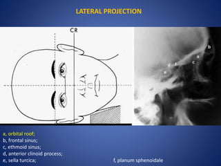 LATERAL PROJECTION
a, orbital roof;
b, frontal sinus;
c, ethmoid sinus;
d, anterior clinoid process;
e, sella turcica; f, planum sphenoidale
 
