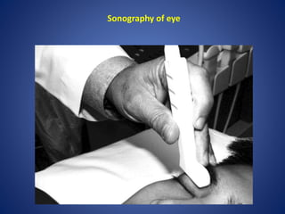 Sonography of eye
 